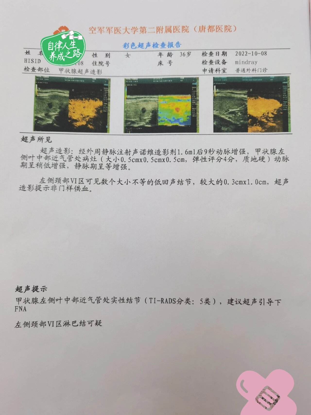 西安确诊病例怎么一下子增多了.西安的确诊病例