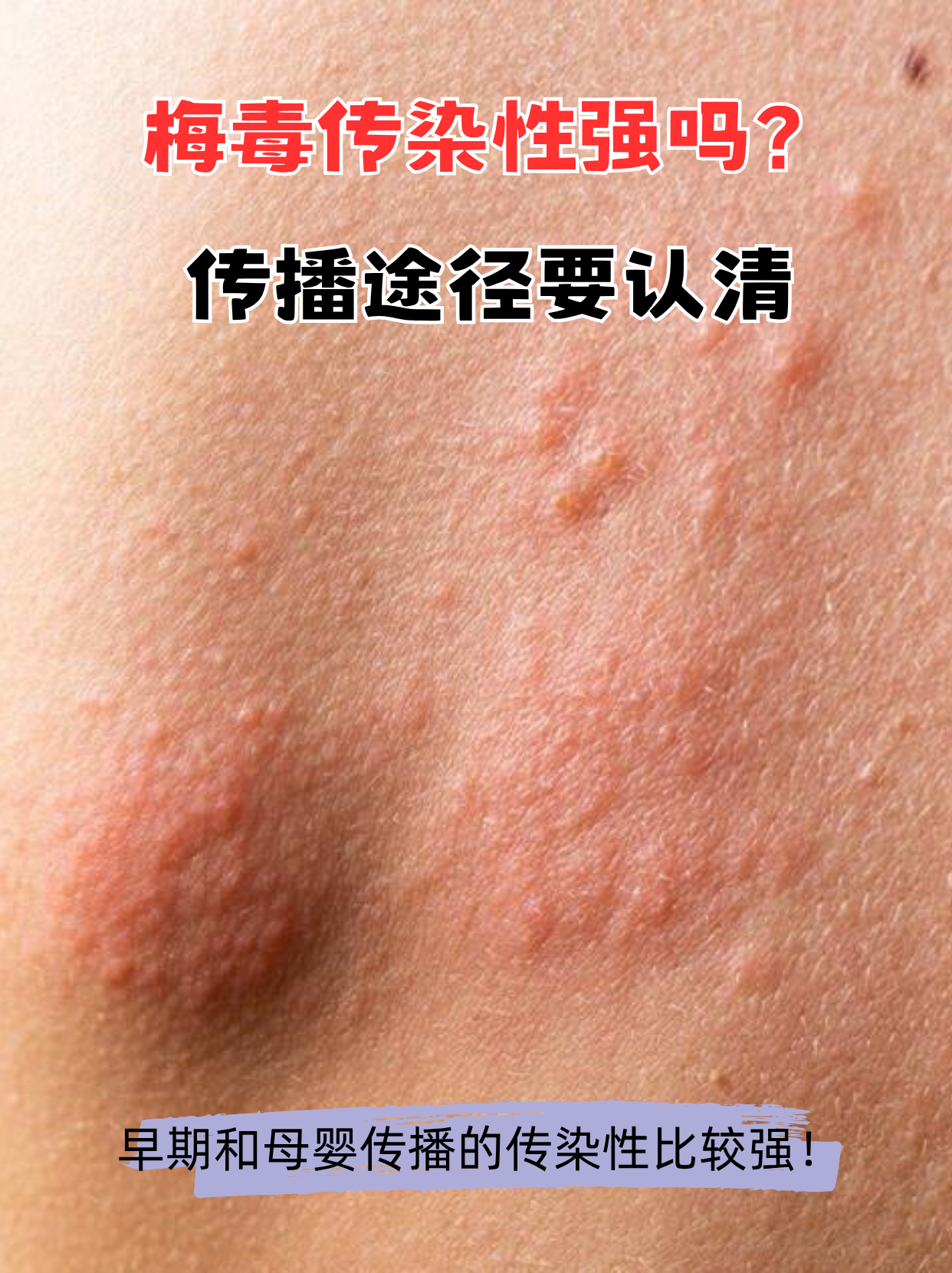 「南京疫情传播源头」〃南京疫情传播什么病毒-第2张图片